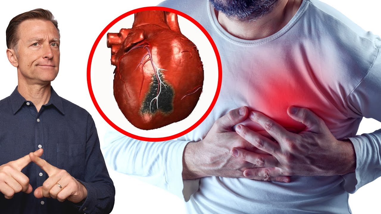 The #1 Best Remedy to Prevent a Heart Attack for $3.19