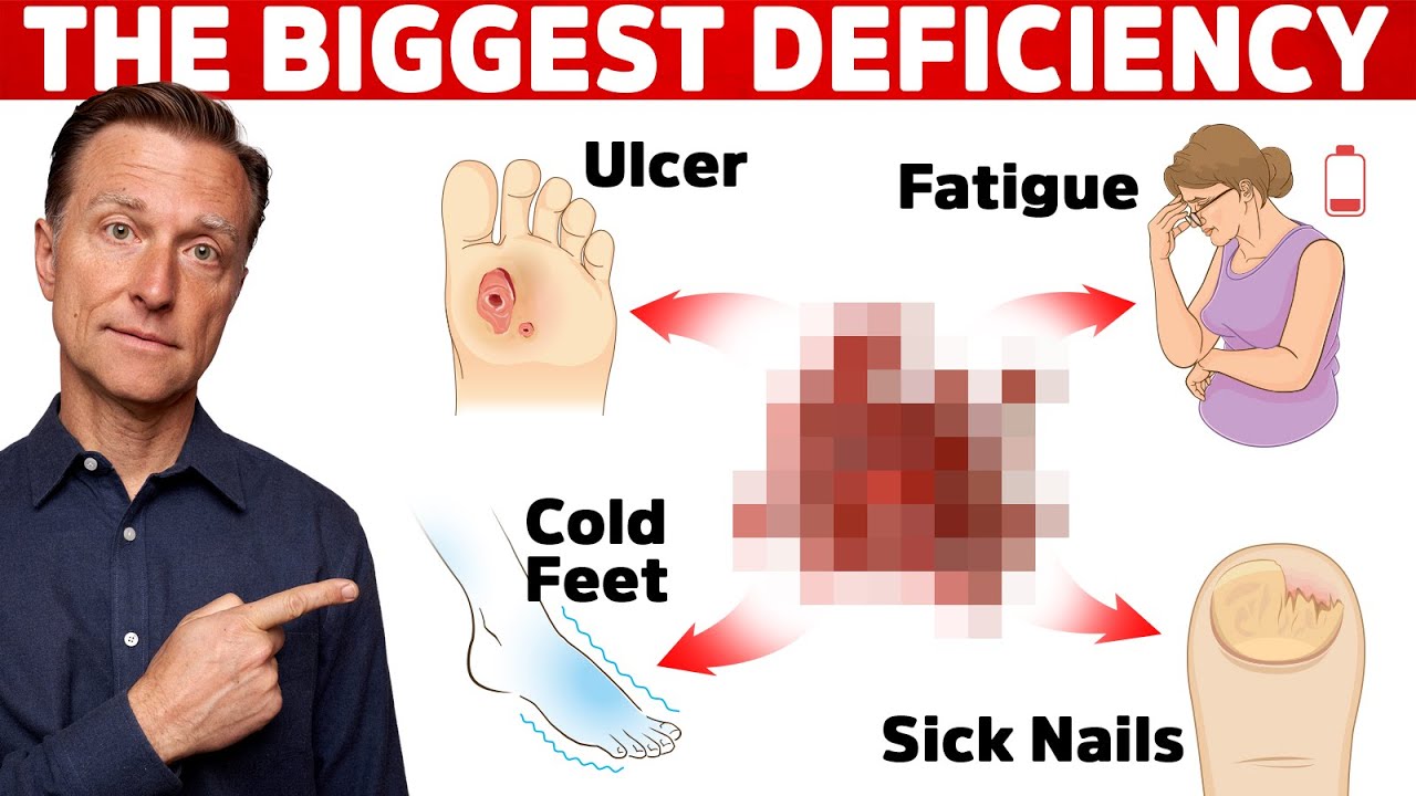 The #1 Most Common Mineral Deficiency in the World