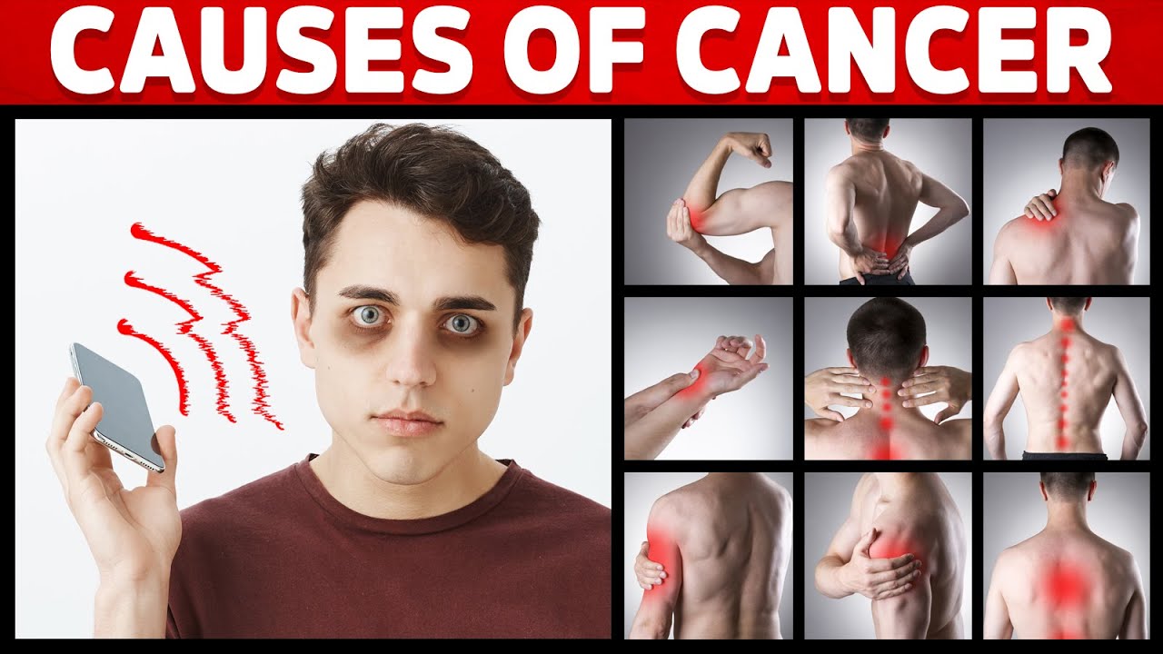 7 Causes of Cancer You’ve Never Heard About