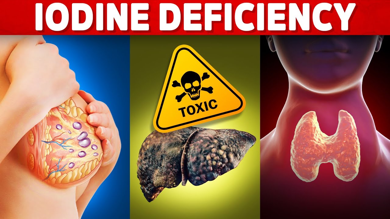 The 5 Signs and Symptoms of an Iodine Deficiency You’ve Never Heard