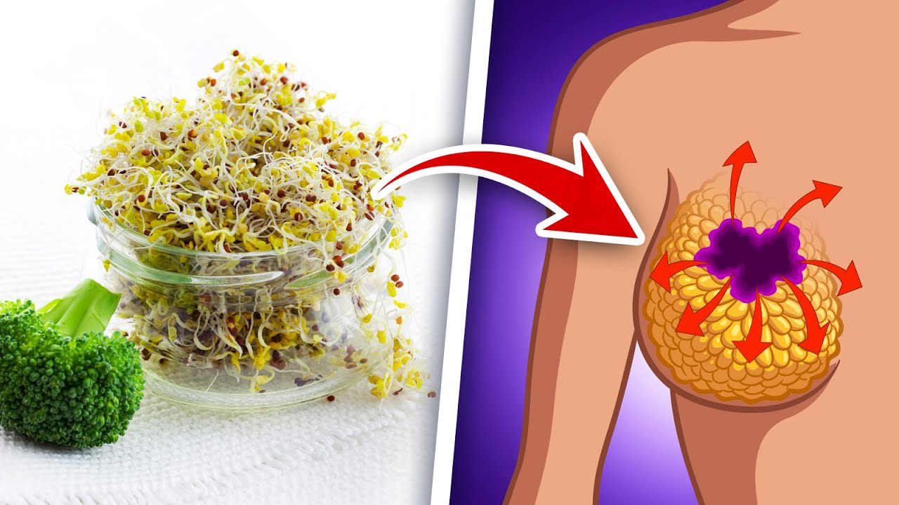 Broccoli Sprouts for Genetic Breast Cancer (BRCA-1)