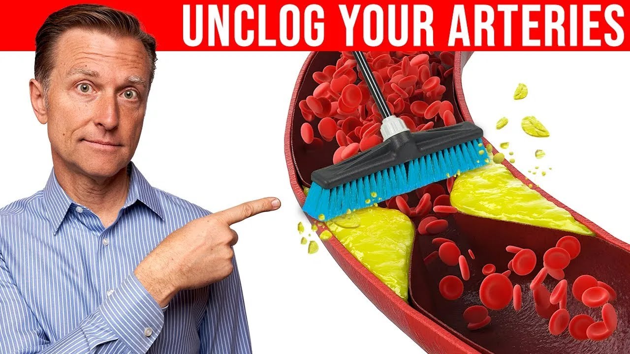 The #1 Best Remedy to Clean Plaque From Your Arteries