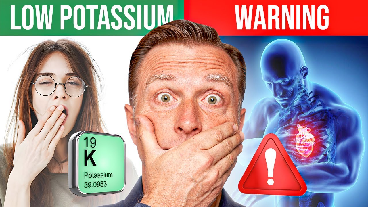 The POTASSIUM Epidemic: Dr. Berg Explains Symptoms, Signs, Diet, Causes, and Treatment