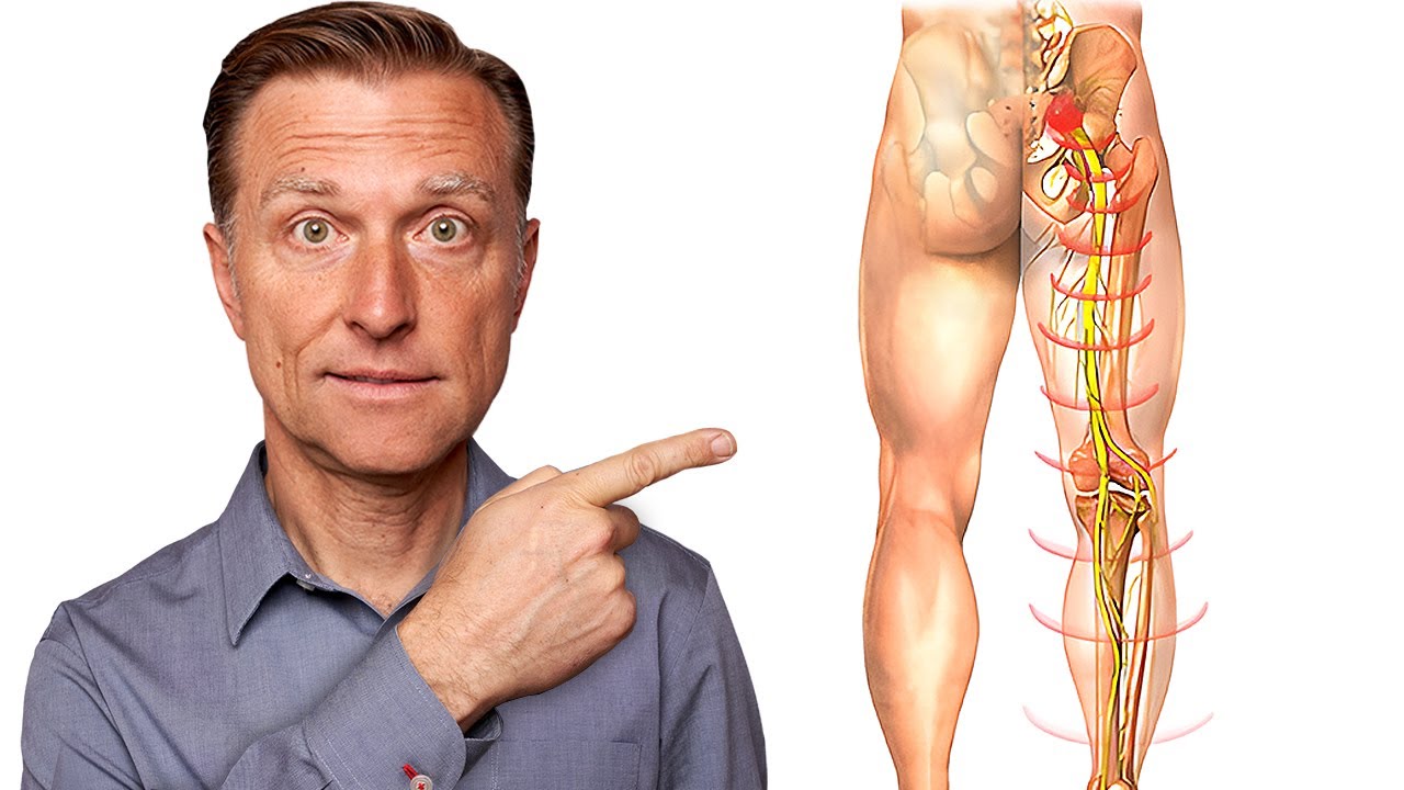 How to Fix Severe Sciatica Pain at HOME