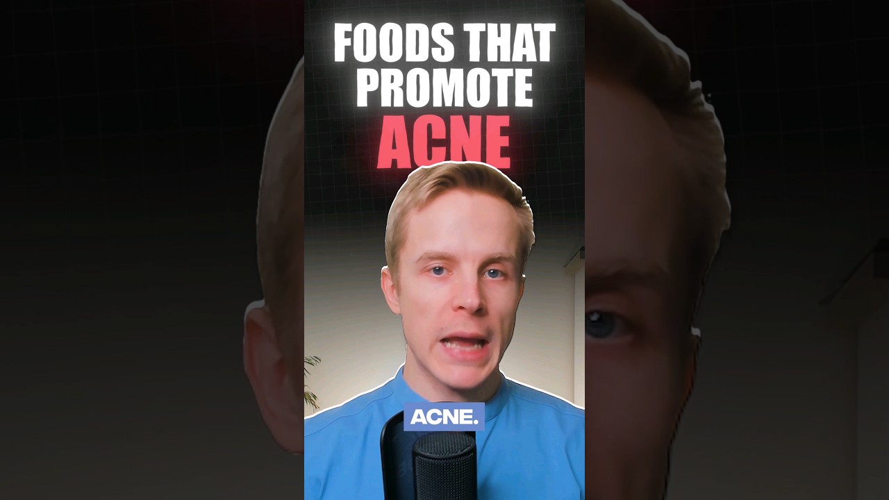 3 Foods That Trigger Acne