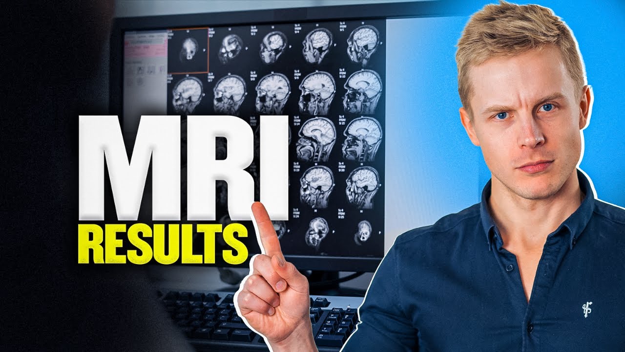 I Got a Full Body MRI and This Is What Happened
