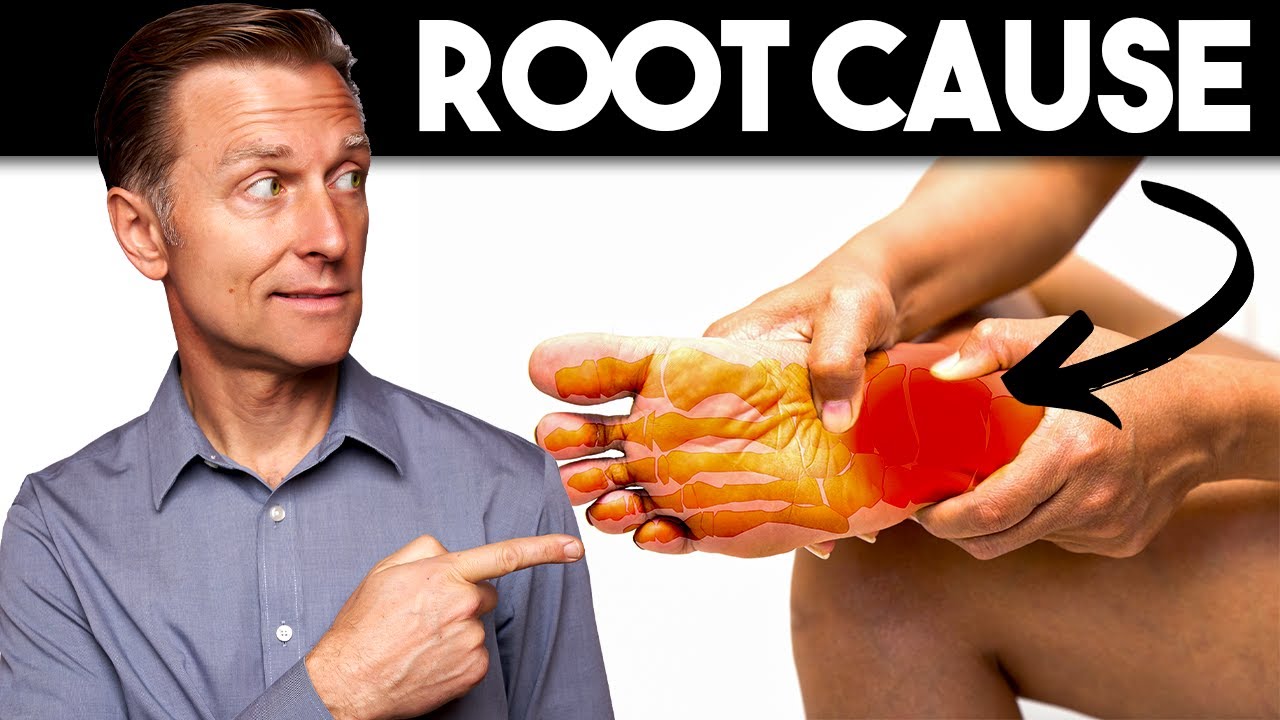 Peripheral NEUROPATHY (Root Cause and Best Remedy) — Dr. Berg