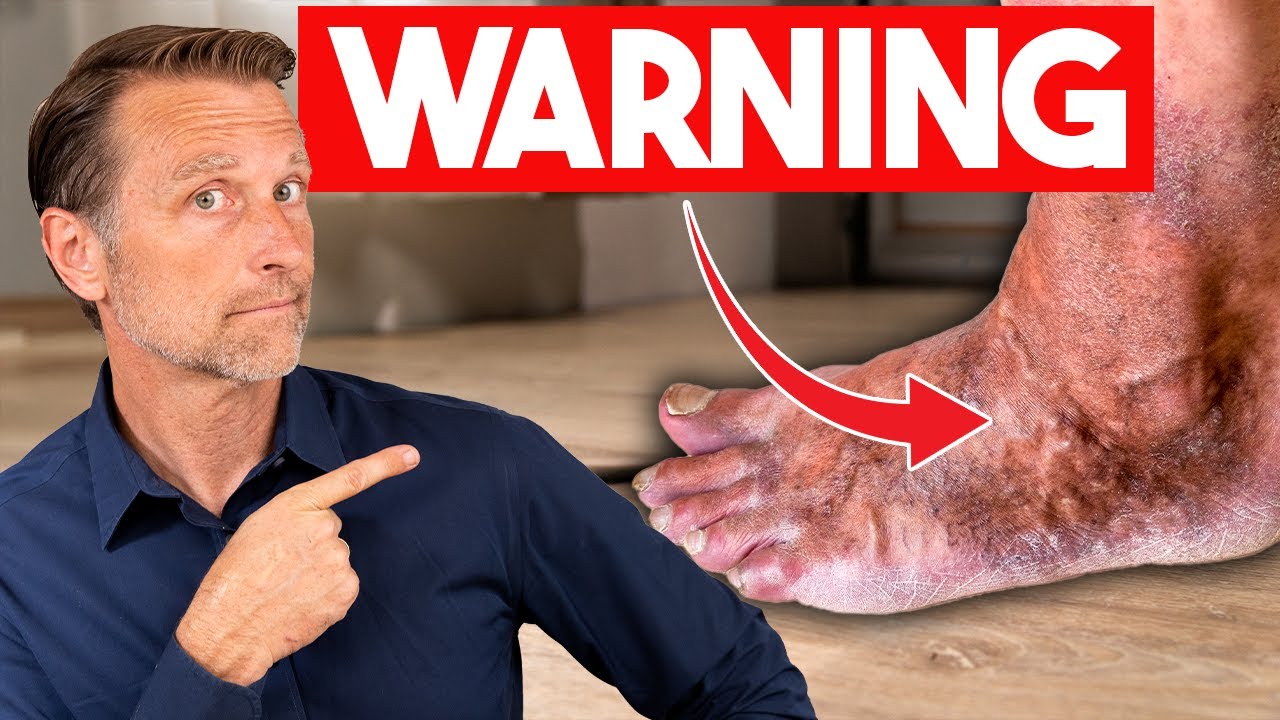 Your Feet Reveals Diseases